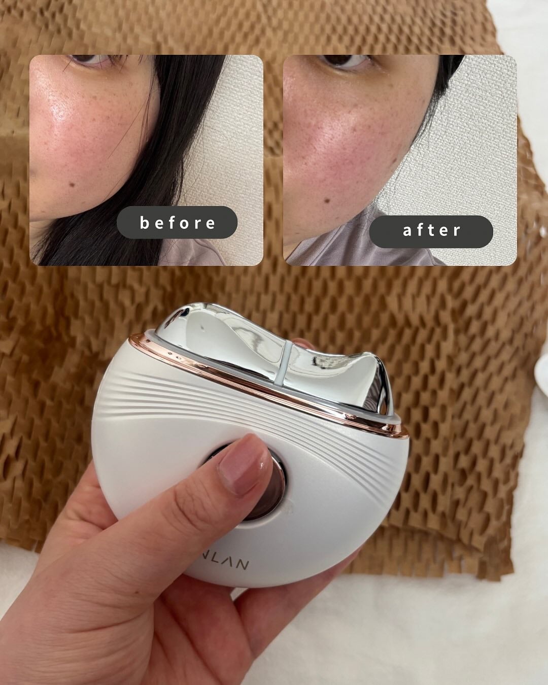 温冷リフトかっさ/ANLAN/美顔器・マッサージを使ったクチコミ(5枚目)