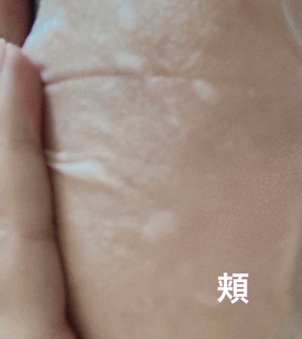 ブラックPDRN デイリーシートマスク/ネイチャーリパブリック/シートマスク・パックを使ったクチコミ(5枚目)