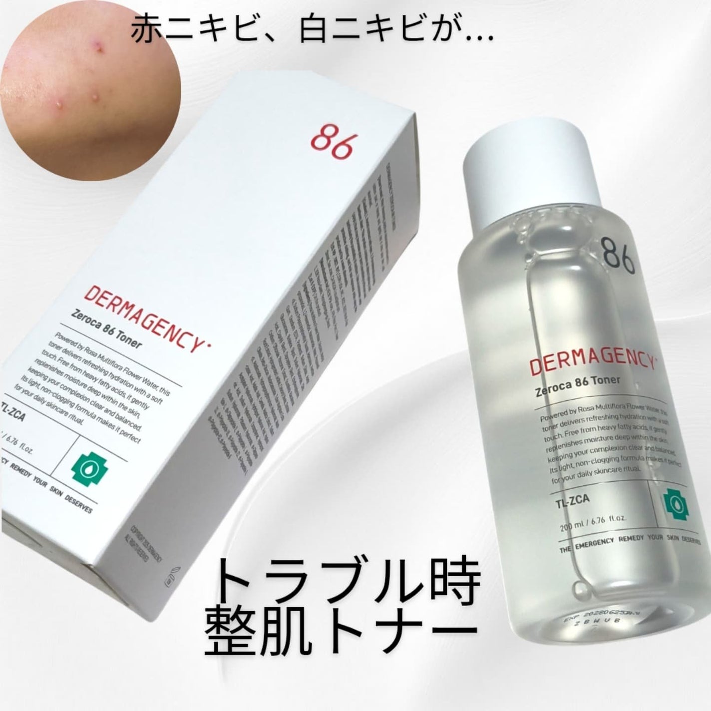 ダーマジェンシー ゼロカ86 トナー/DERMAGENCY/化粧水を使ったクチコミ(2枚目)