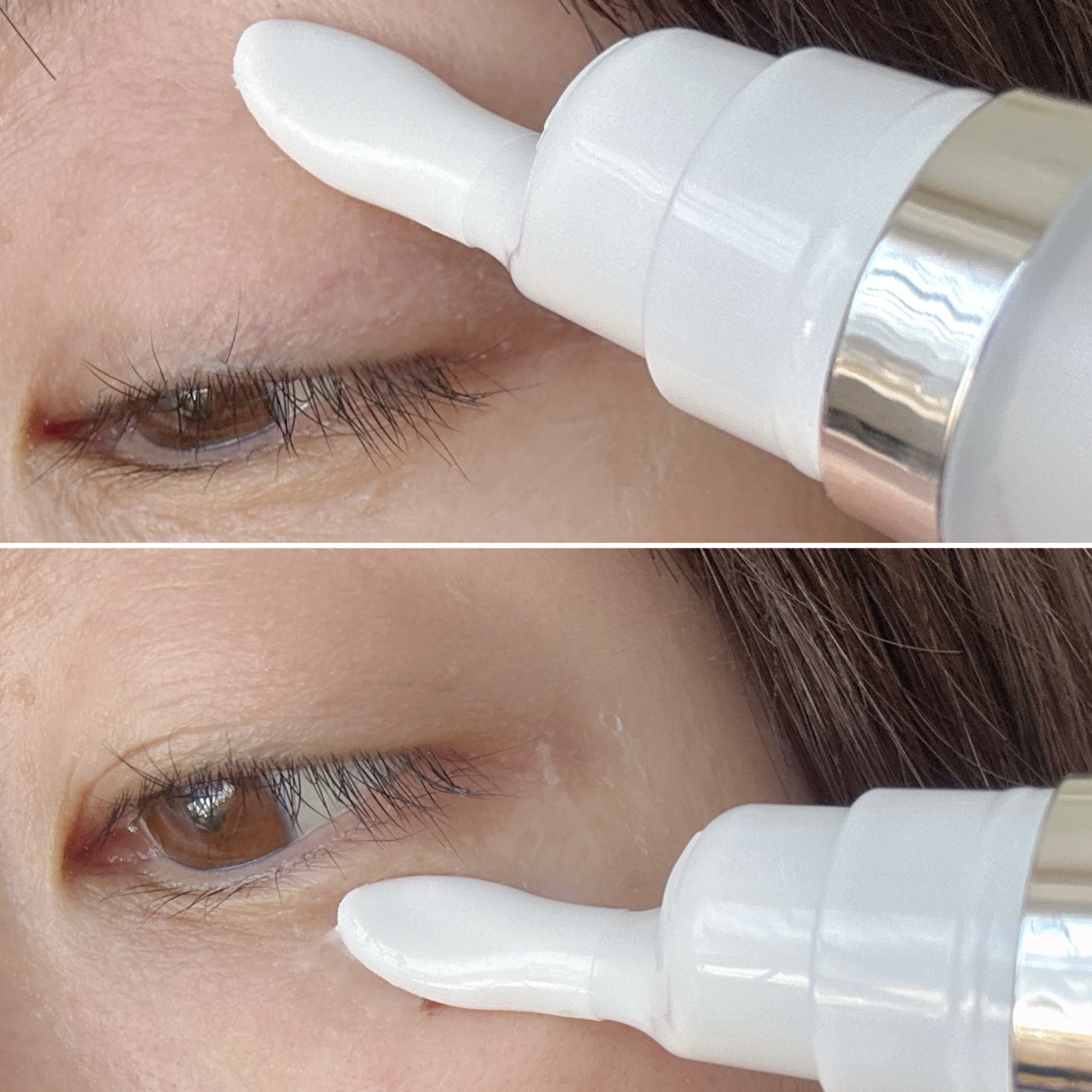 lujo ニードルセラム/lujo/美容液を使ったクチコミ（3枚目）