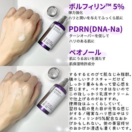 アットクリニック ハイパーPトーニング美容液/DOMINAS/美容液を使ったクチコミ(3枚目)