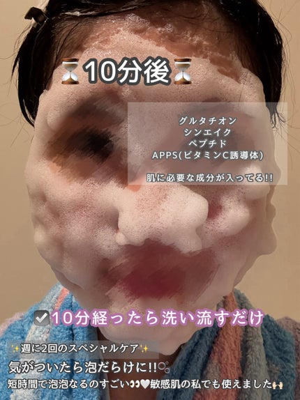 ð on LIPS ããžã§ã«ã ã£ãã®ãæéãçµã€ãšãã
ããã
ãæ³¡ãã§ãŠããŠ10ååŸã«..ãïŒ4æç®ïŒ