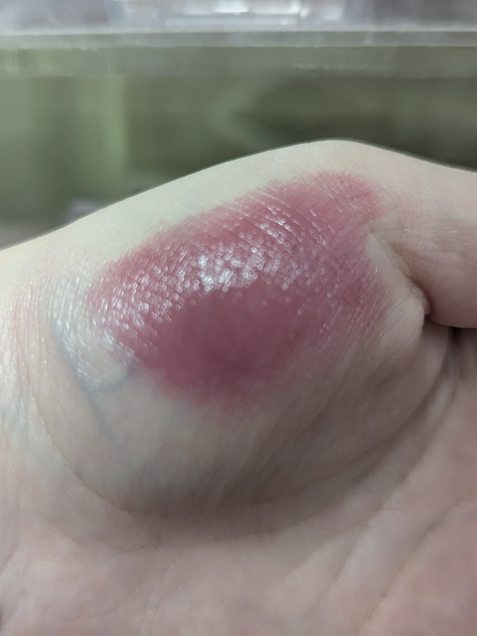 KM メルティーリップバーム/Kyumme/口紅を使ったクチコミ（3枚目）