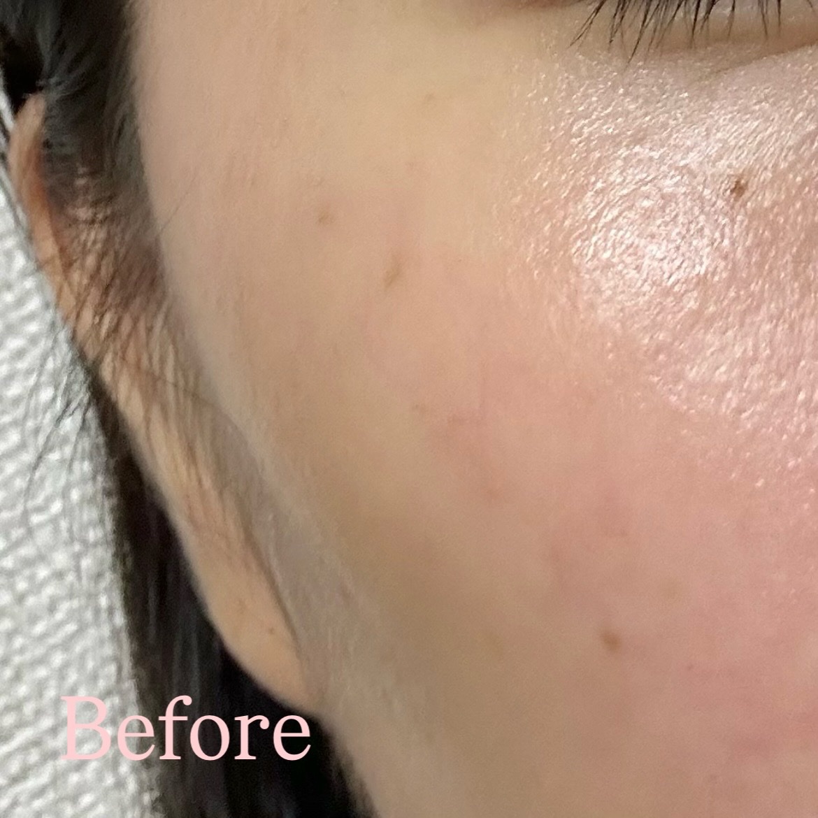 スキンブースティングフォルテセラム/essenciel/美容液を使ったクチコミ（3枚目）