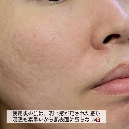 ヨル スキン オーバーナイトセラム クリア/YOLU/美容液を使ったクチコミ(5枚目)