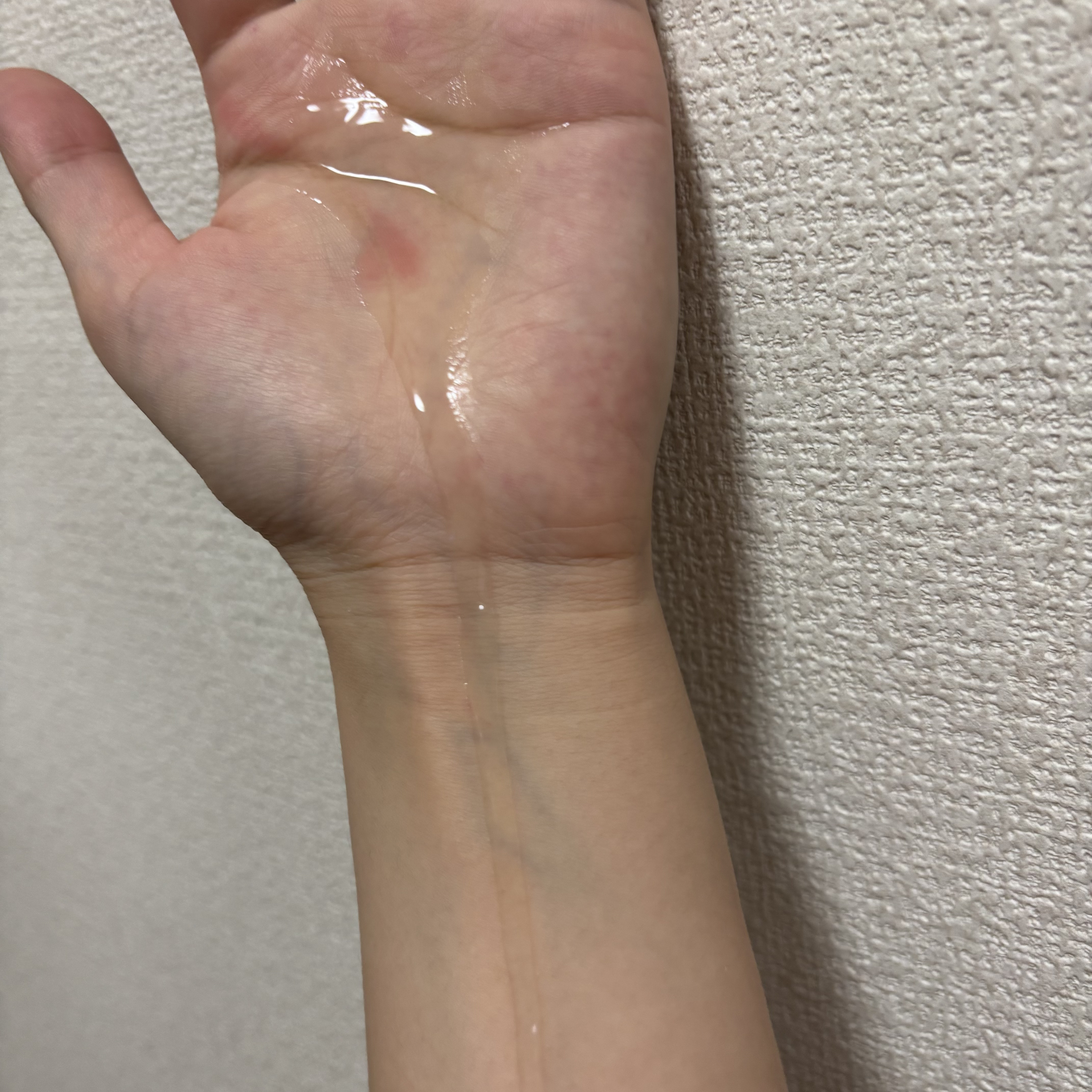 ダーマジェンシー ゼロカ86 トナー/DERMAGENCY/化粧水を使ったクチコミ（3枚目）