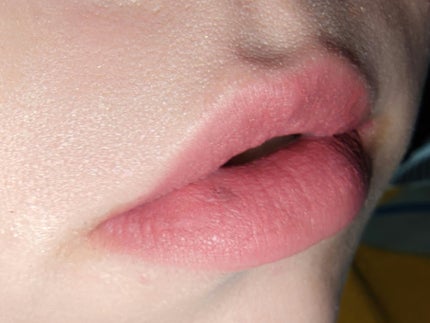 チーク ポップ/CLINIQUE/パウダーチークを使ったクチコミ(5枚目)