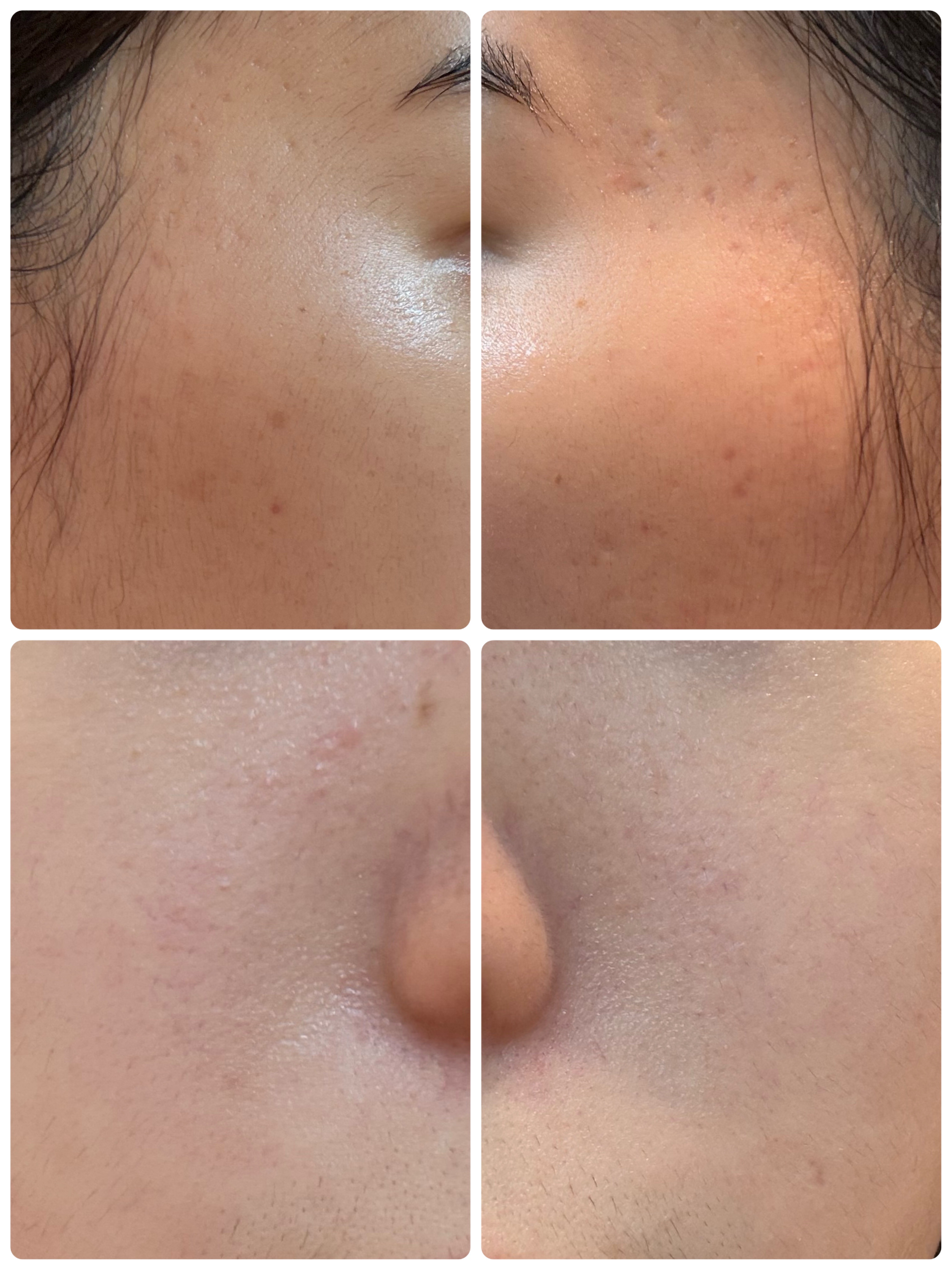 エターナルアイクリーム/リュバンブラン/アイケア・アイクリームを使ったクチコミ（2枚目）