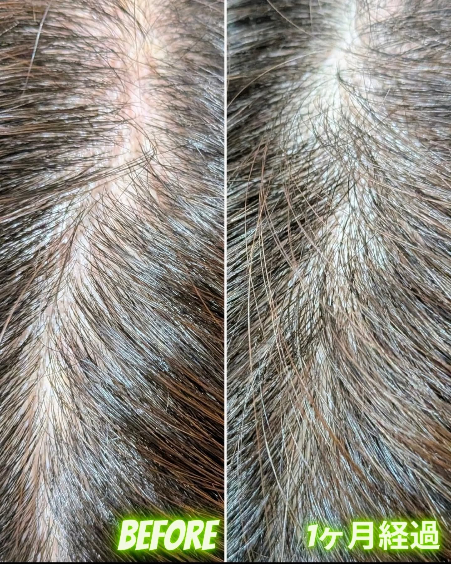 薬用リリィジュ RICH/ウェルベスト/頭皮ローションを使ったクチコミ（3枚目）