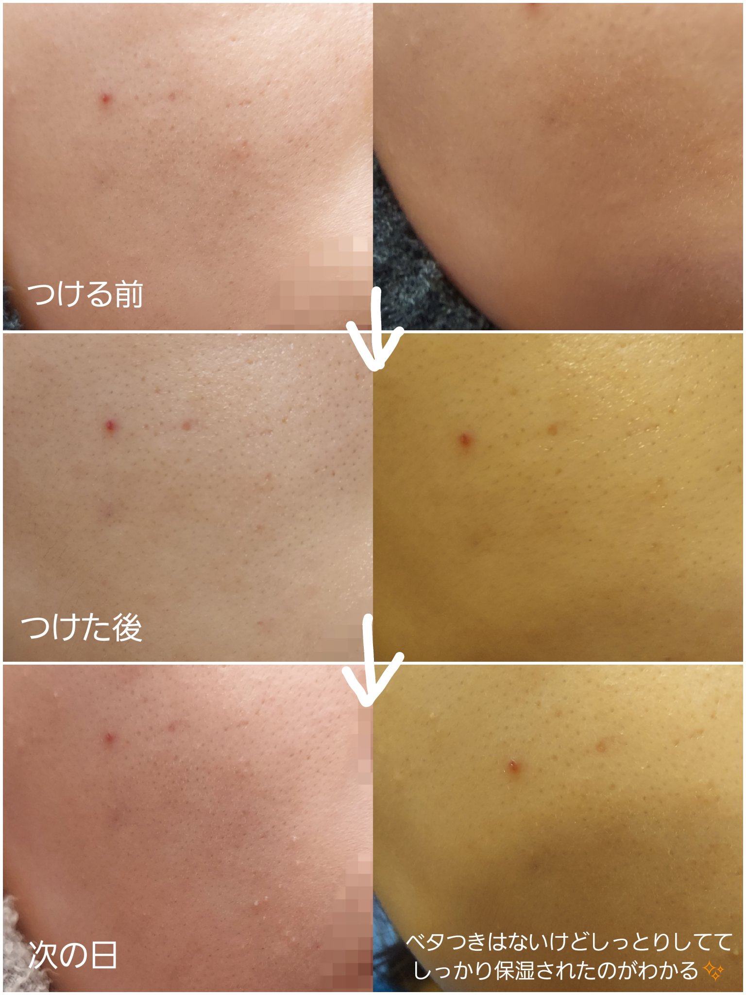 リズム べース デイリーケアマスク（シャイン）/RISM/シートマスク・パックを使ったクチコミ（2枚目）