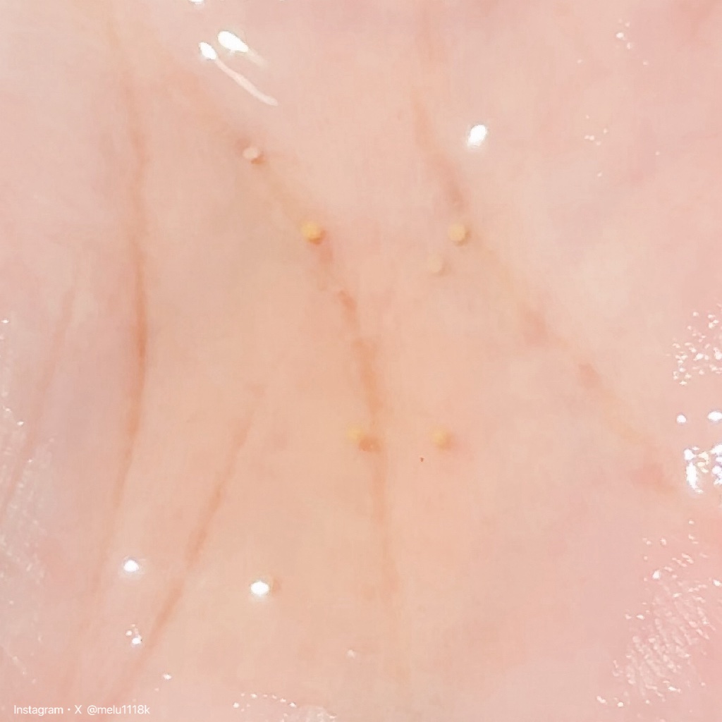 ビタミンアンプル2ml（5本入り）/Spela/美容液を使ったクチコミ（2枚目）