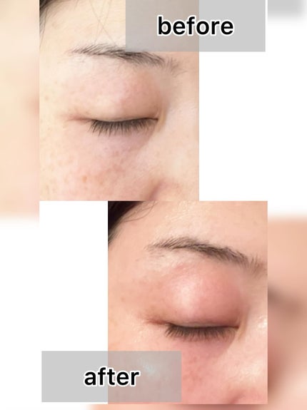 目元美顔器/ANLAN/美顔器・マッサージを使ったクチコミ(6枚目)