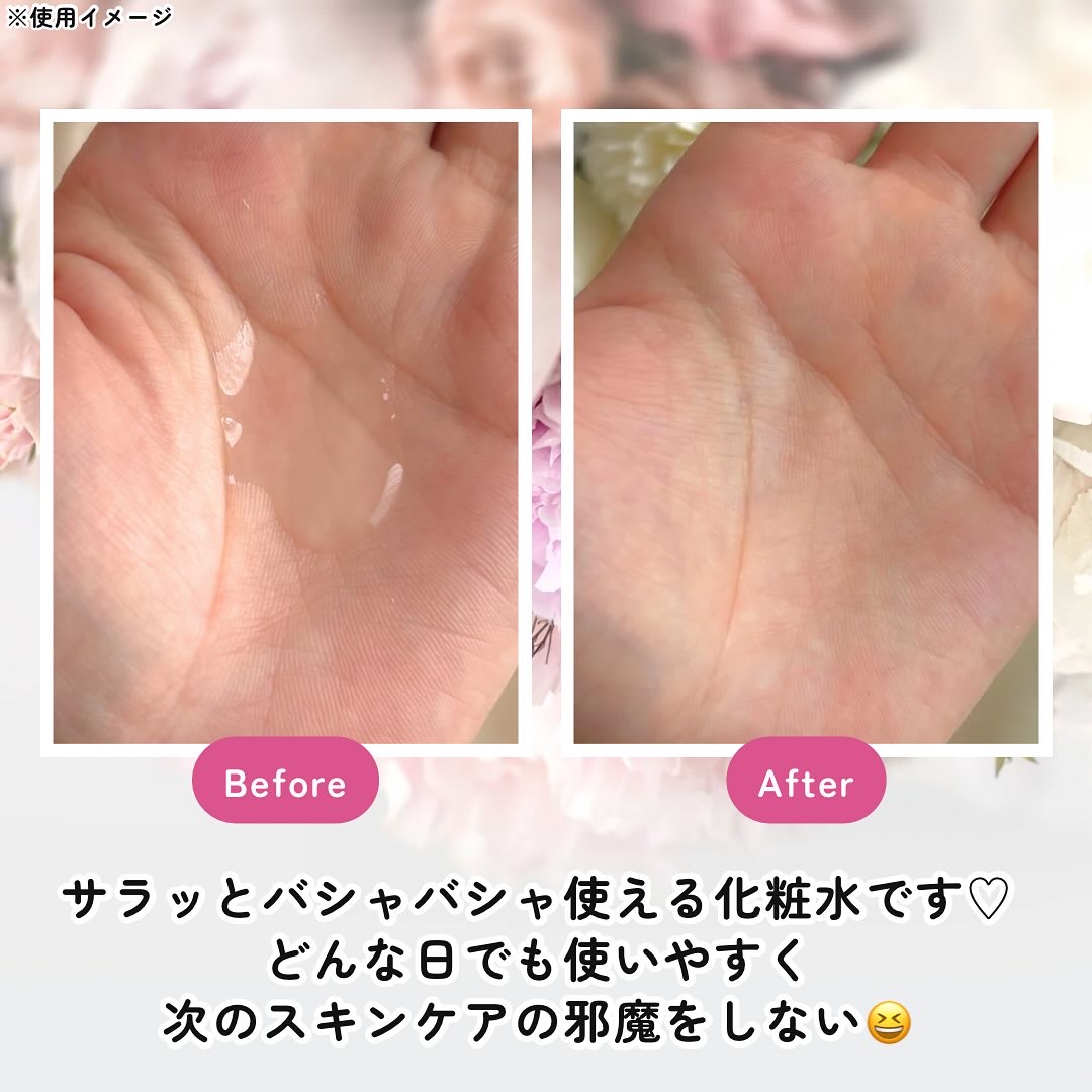 肌美精 CHOI薬用化粧水 ニキビケア[医薬部外品]/肌美精/化粧水を使ったクチコミ（3枚目）