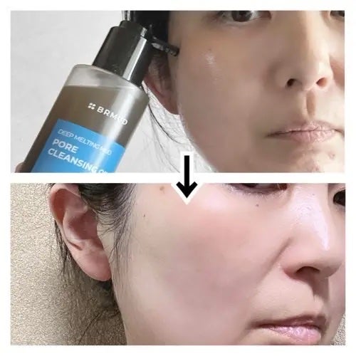 ディープメルティングマッドポアクレンジングオイル/BRMUD/オイルクレンジングを使ったクチコミ(4枚目)
