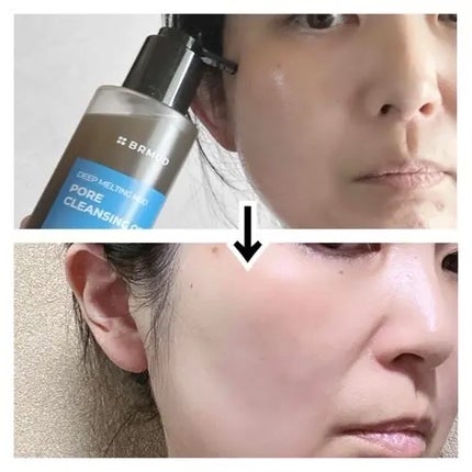 ディープメルティングマッドポアクレンジングオイル/BRMUD/オイルクレンジングを使ったクチコミ(4枚目)