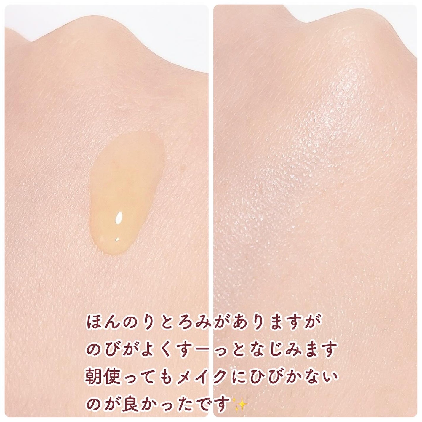 薬用VC ブライトエッセンス/chant a charm /美容液を使ったクチコミ(2枚目)