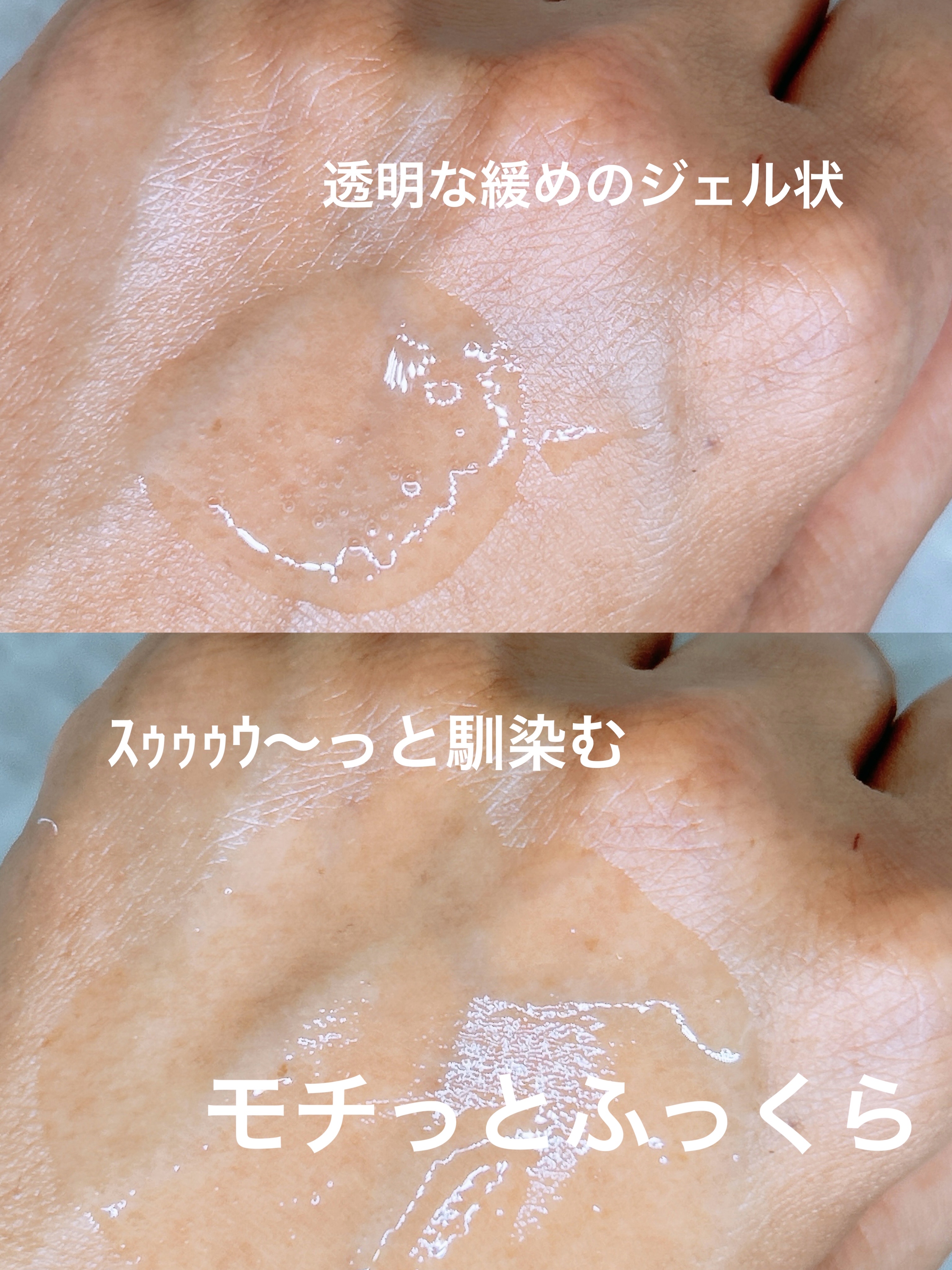 ダーマアールエックスアンプル/OGANACELL/美容液を使ったクチコミ（3枚目）