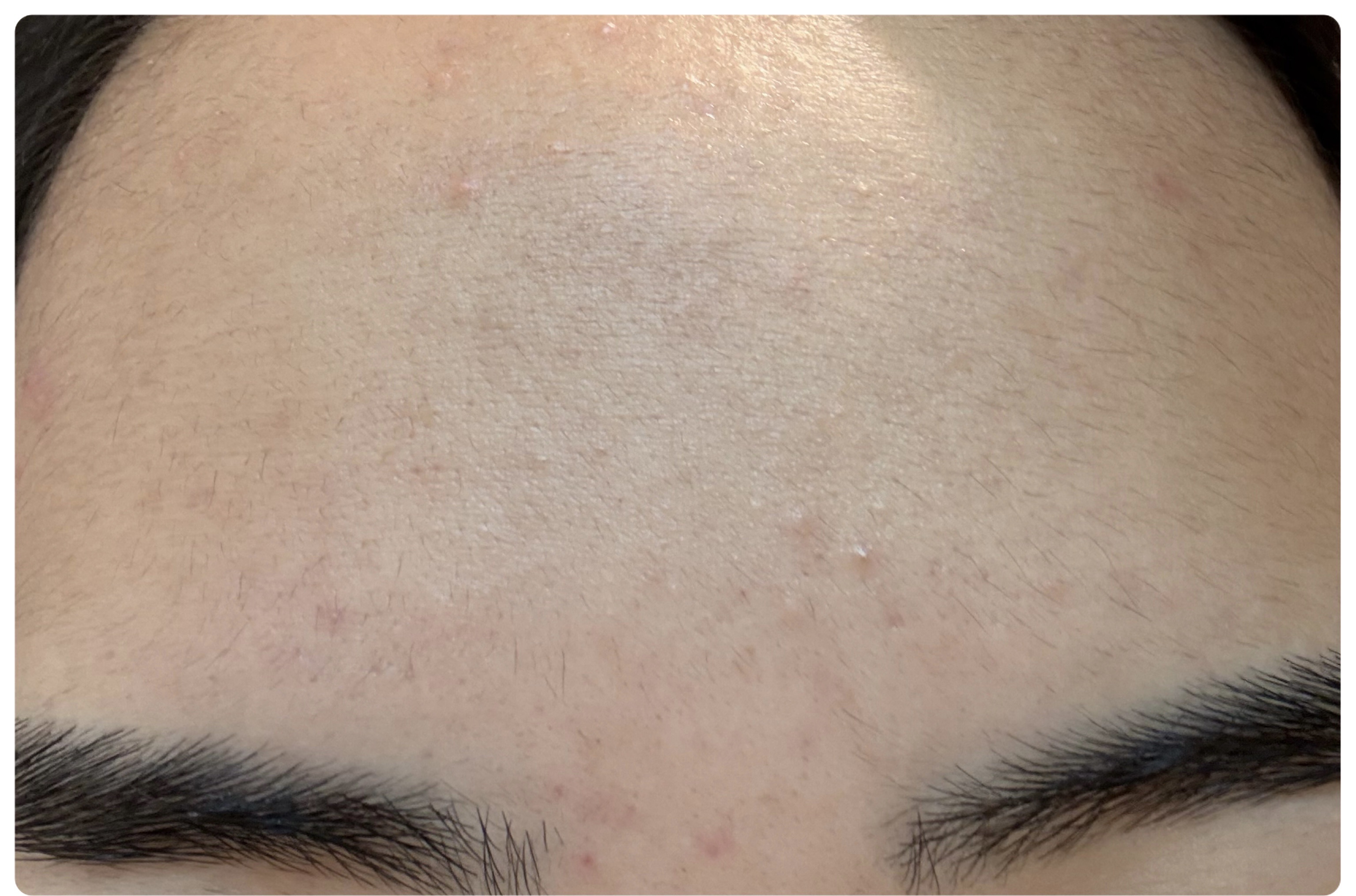 エターナルアイクリーム/リュバンブラン/アイケア・アイクリームを使ったクチコミ（3枚目）