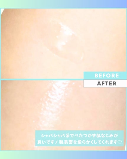 Abo on LIPS 「やっほーAboです🤍✨🌟LACIDEM🌟🩷シートマスク前の導入..」(4枚目)