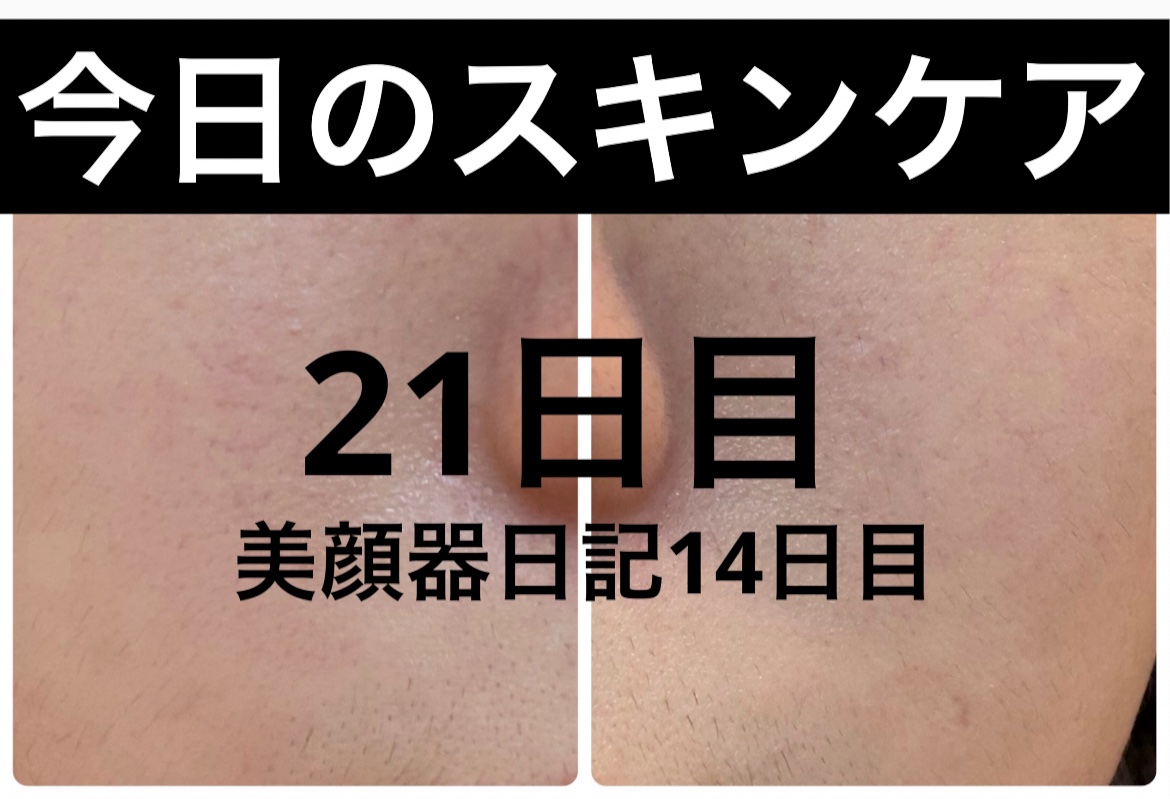 エターナルアイクリーム/リュバンブラン/アイケア・アイクリームを使ったクチコミ（1枚目）