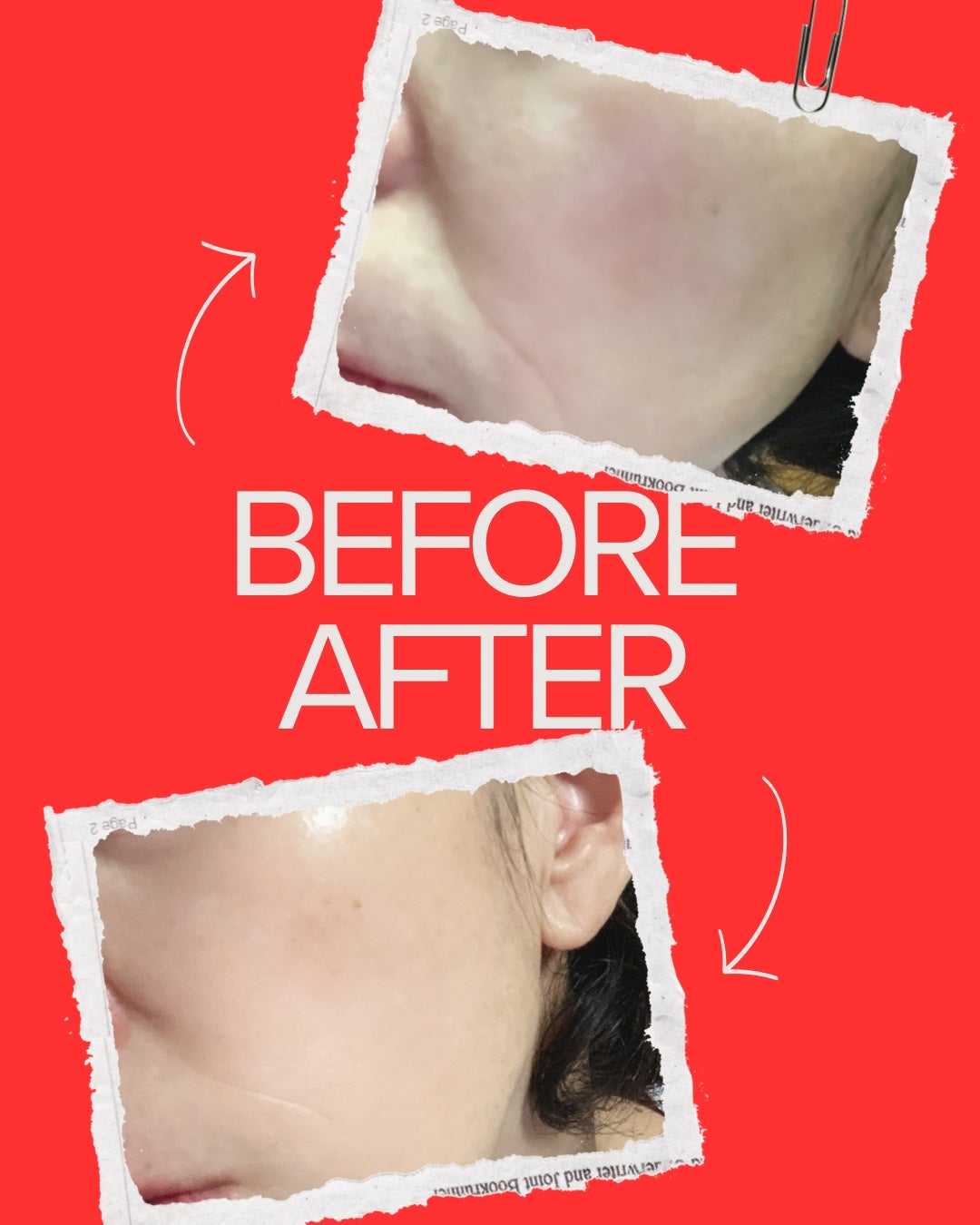 A1カーミング アンプル/VT/美容液を使ったクチコミ(5枚目)