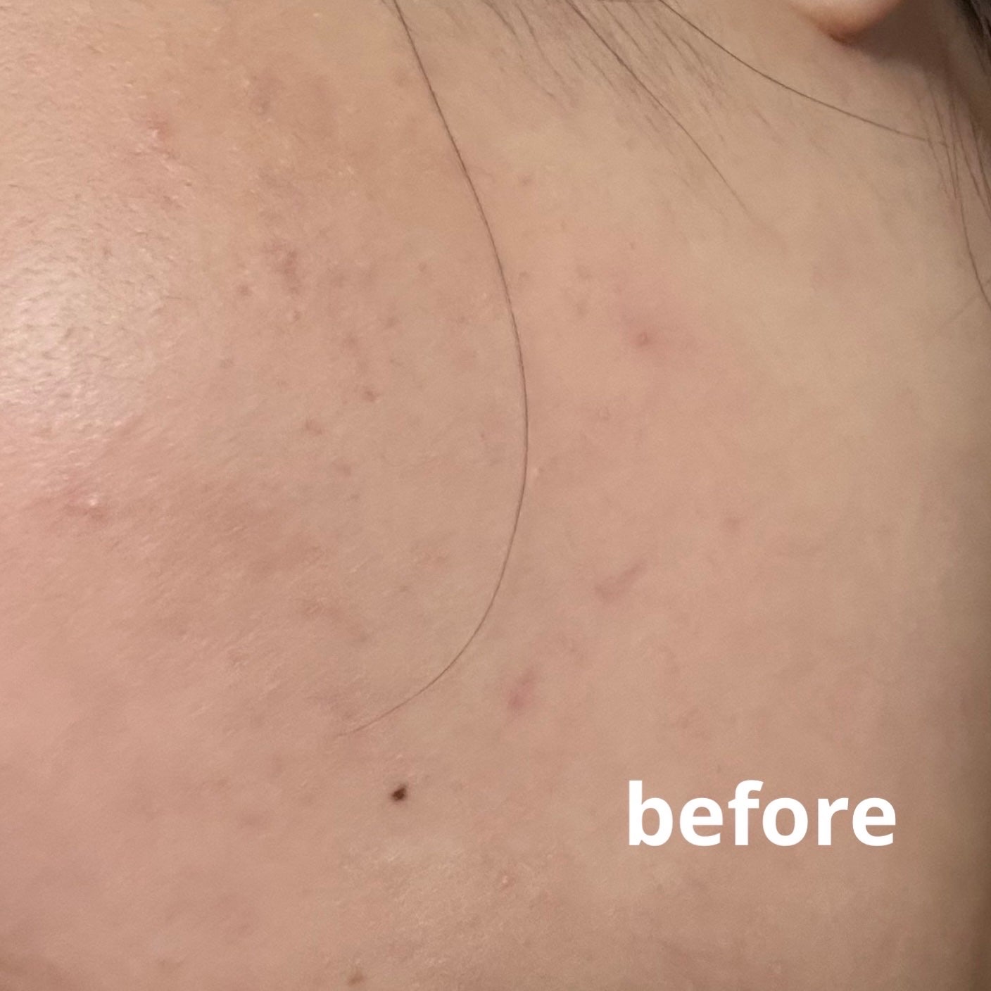 ダーマジェンシー ゼロカ81 クリーム/DERMAGENCY/フェイスクリームを使ったクチコミ(4枚目)