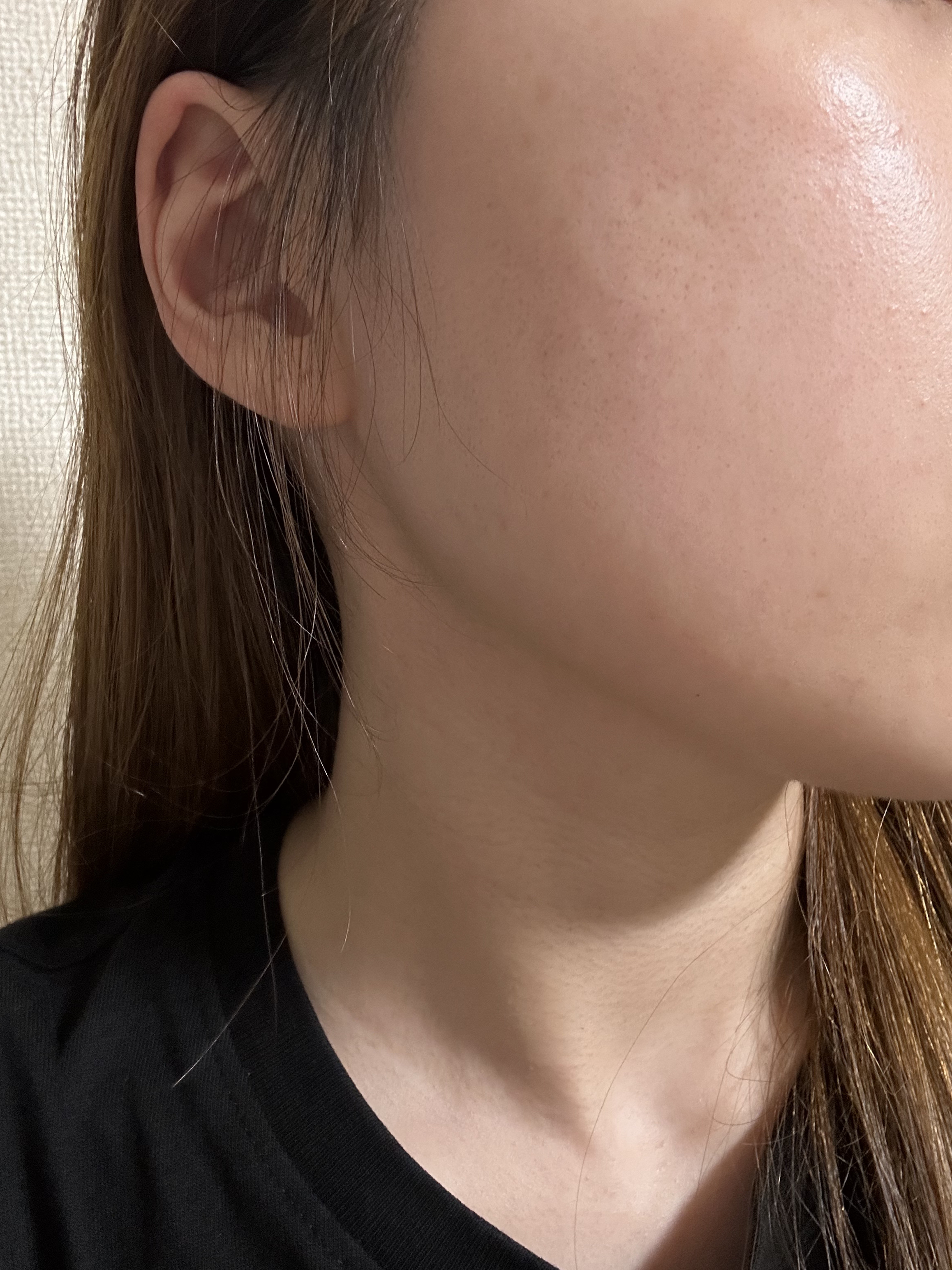 毛穴マスクポアレーザー7DAYSパック/YAMMY’S TOY/シートマスク・パックを使ったクチコミ（2枚目）