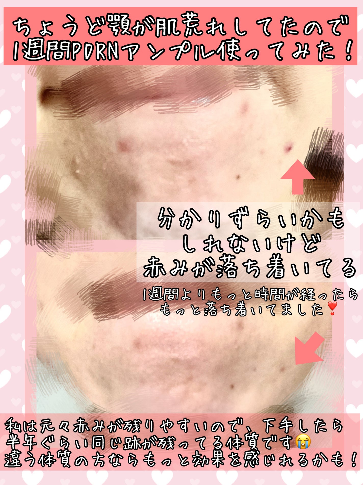 PDRNピンクアンプル PDRN 10,000ppm配合/MEDICUBE/美容液を使ったクチコミ(3枚目)