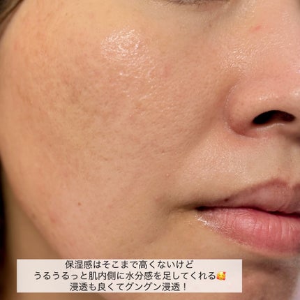 ダーマジェンシー ゼロカ81 セラム/DERMAGENCY/美容液を使ったクチコミ(5枚目)