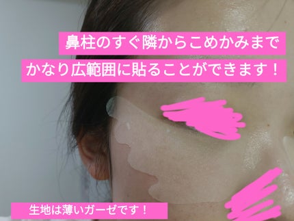 ごめんね素肌 スポットケアマスク/クリアターン/シートマスク・パックを使ったクチコミ(2枚目)