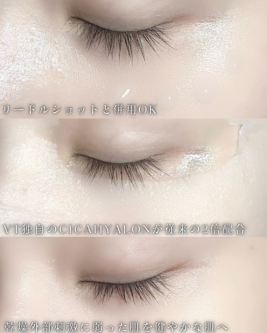 リードルショット100/VT/美容液を使ったクチコミ（2枚目）