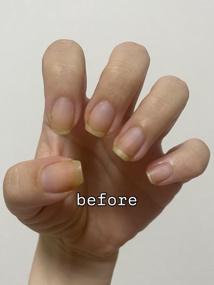 キューティーク/ORLY/ネイルオイル・トリートメントを使ったクチコミ(2枚目)