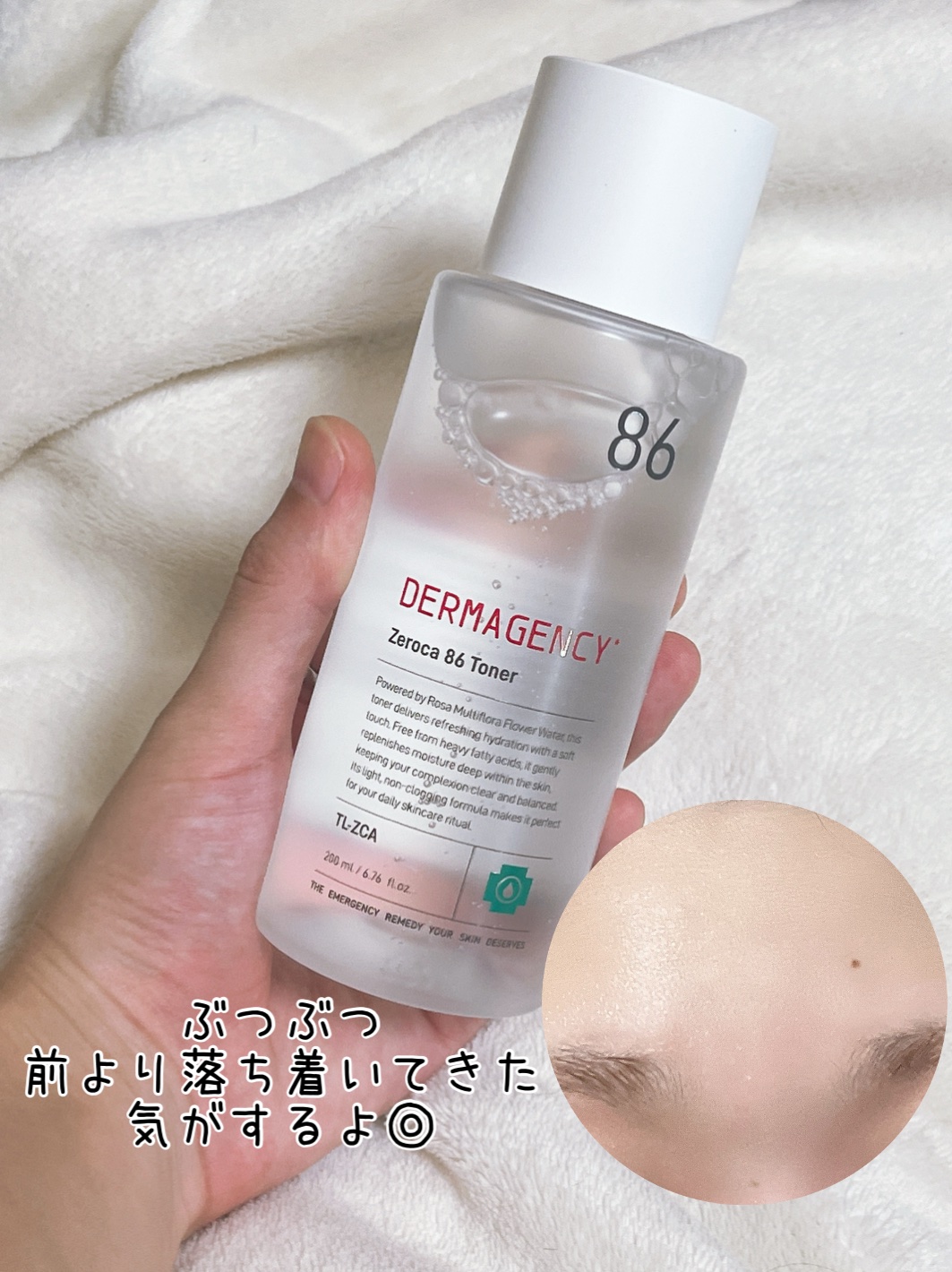 ダーマジェンシー ゼロカ86 トナー/DERMAGENCY/化粧水を使ったクチコミ（3枚目）
