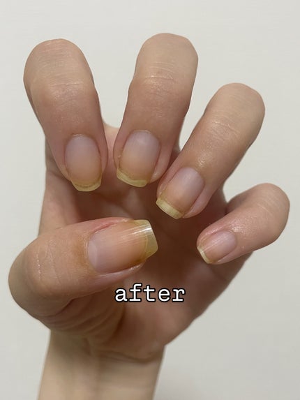 キューティーク/ORLY/ネイルオイル・トリートメントを使ったクチコミ(3枚目)