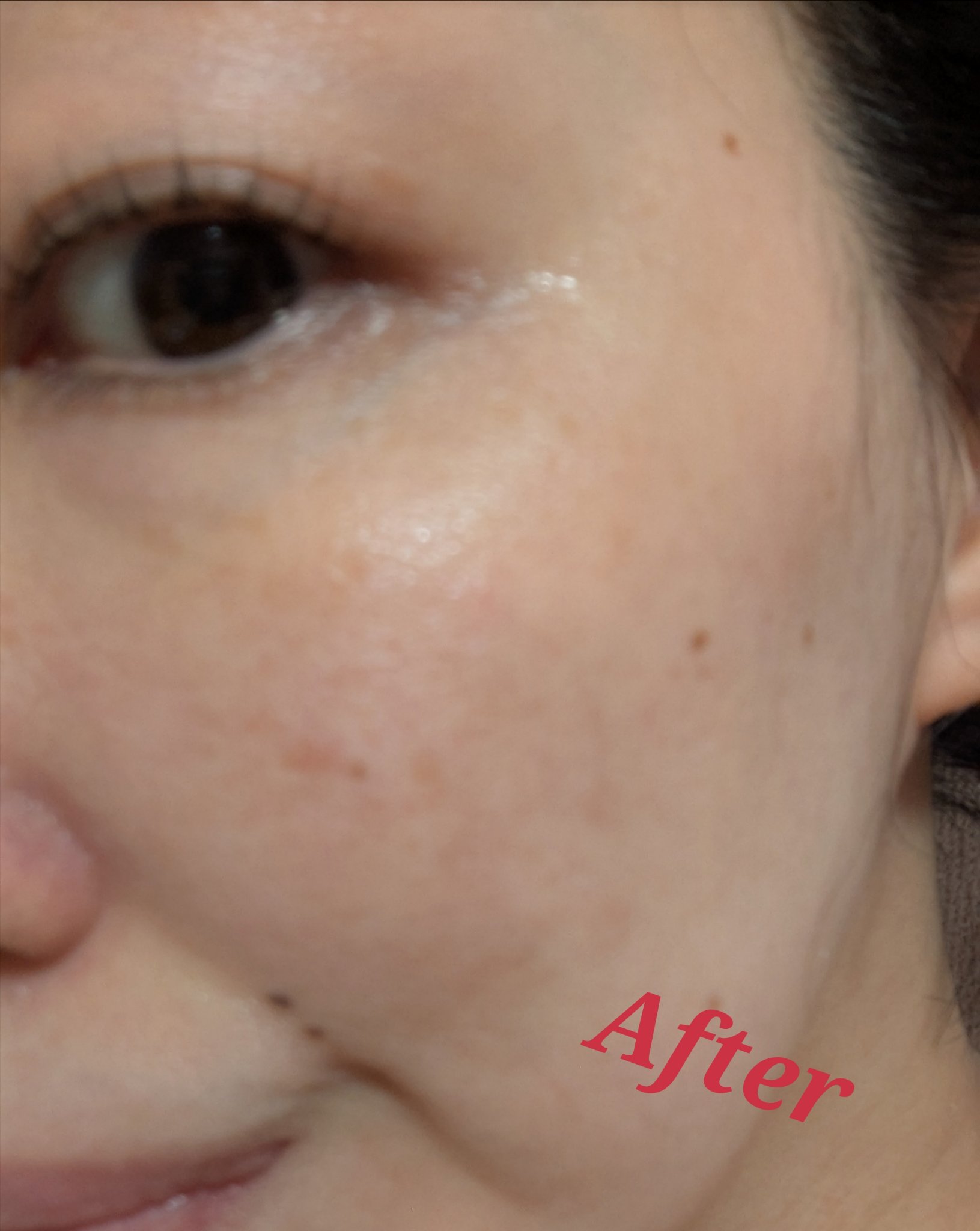 TXトーニングエッセンス2000/VT/美容液を使ったクチコミ（3枚目）