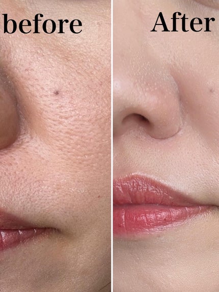 パーフェクト トリプルリポ サンシールド UV/Sefilaty/日焼け止めクリームを使ったクチコミ(6枚目)