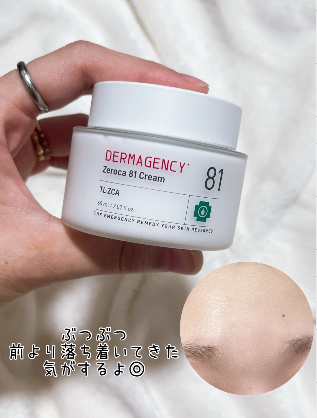 ダーマジェンシー ゼロカ81 クリーム/DERMAGENCY/フェイスクリームを使ったクチコミ（3枚目）