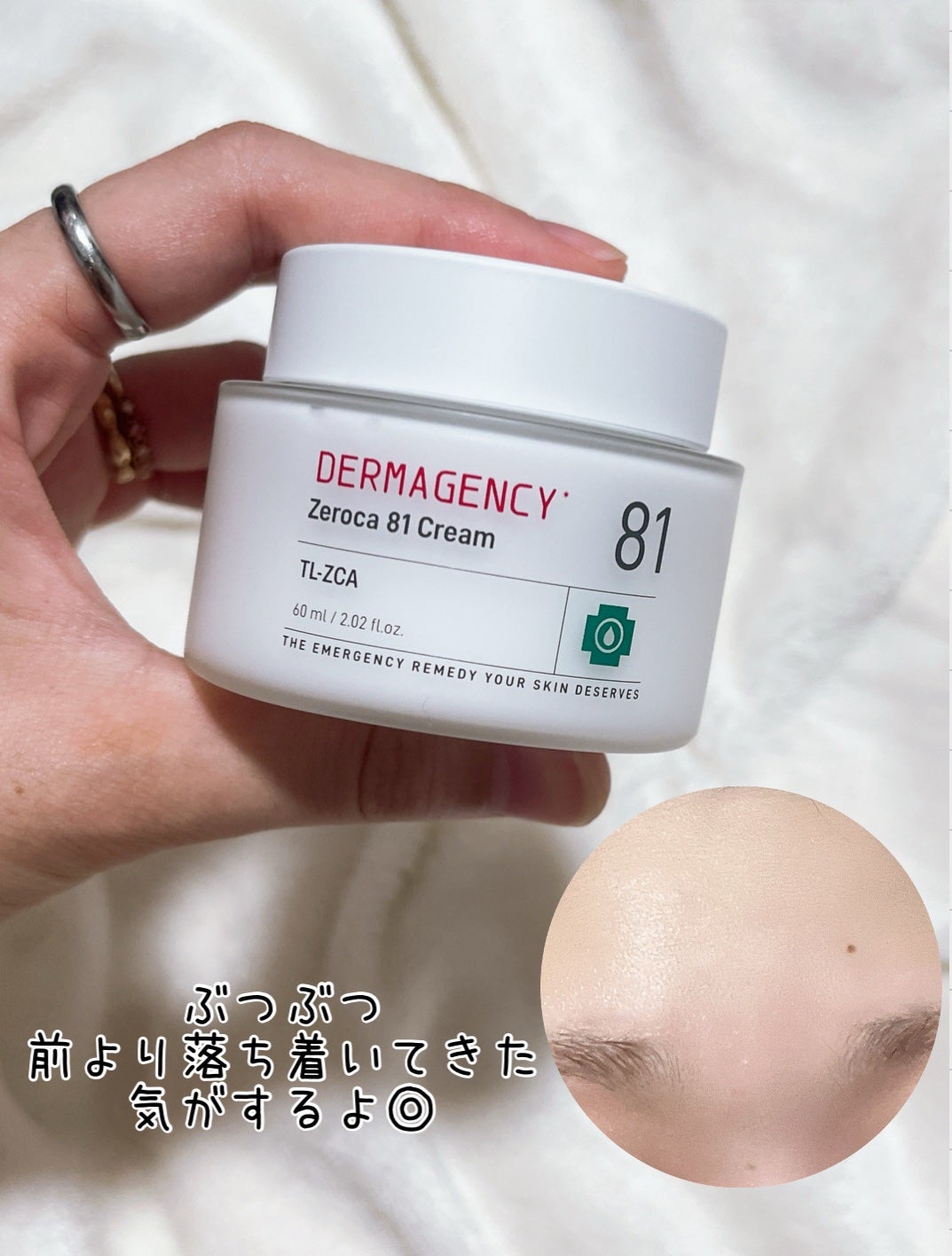 ダーマジェンシー ゼロカ81 クリーム/DERMAGENCY/フェイスクリームを使ったクチコミ(3枚目)