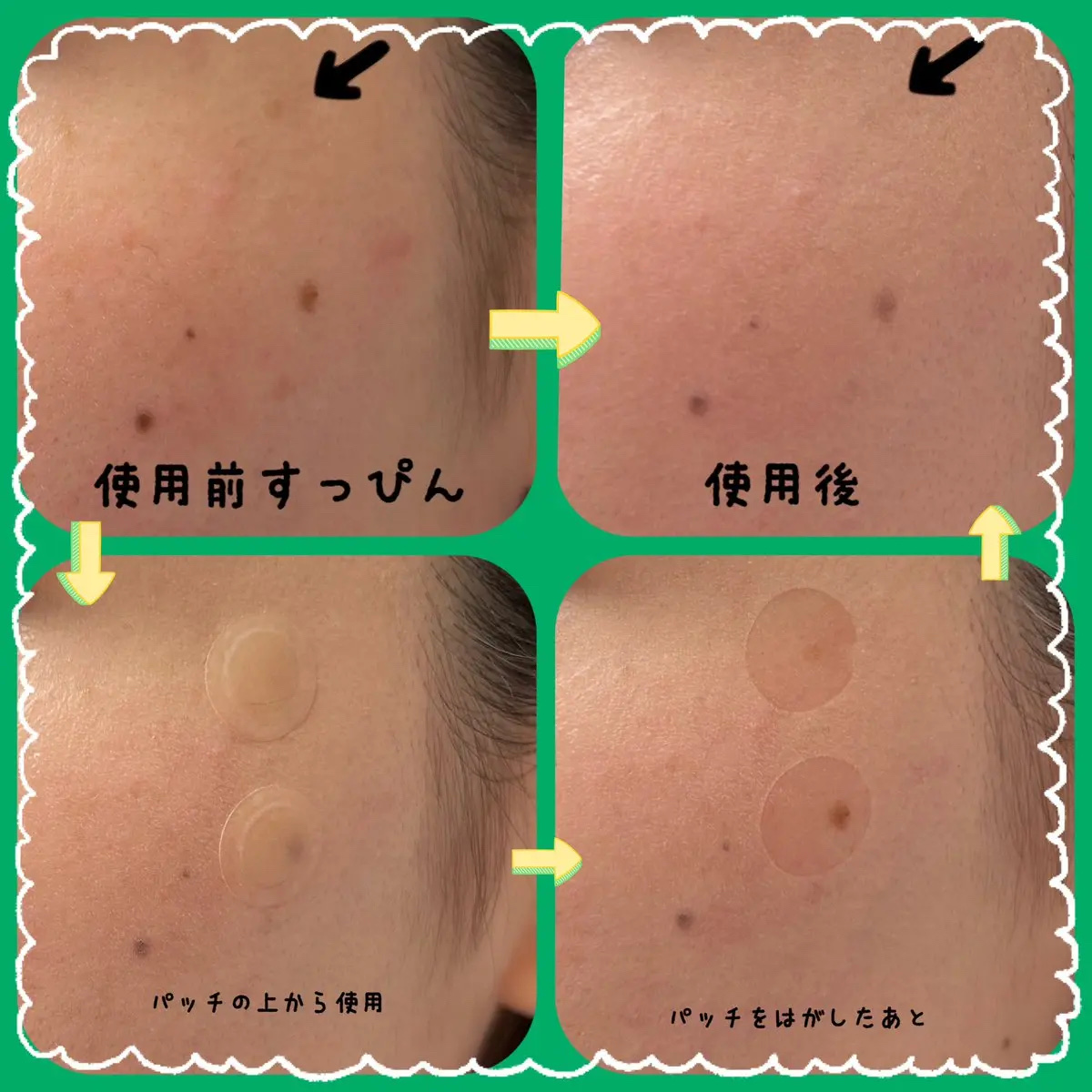 イージーデュー メラB トーニングセラムクッション/Easydew/クッションファンデーションを使ったクチコミ（2枚目）