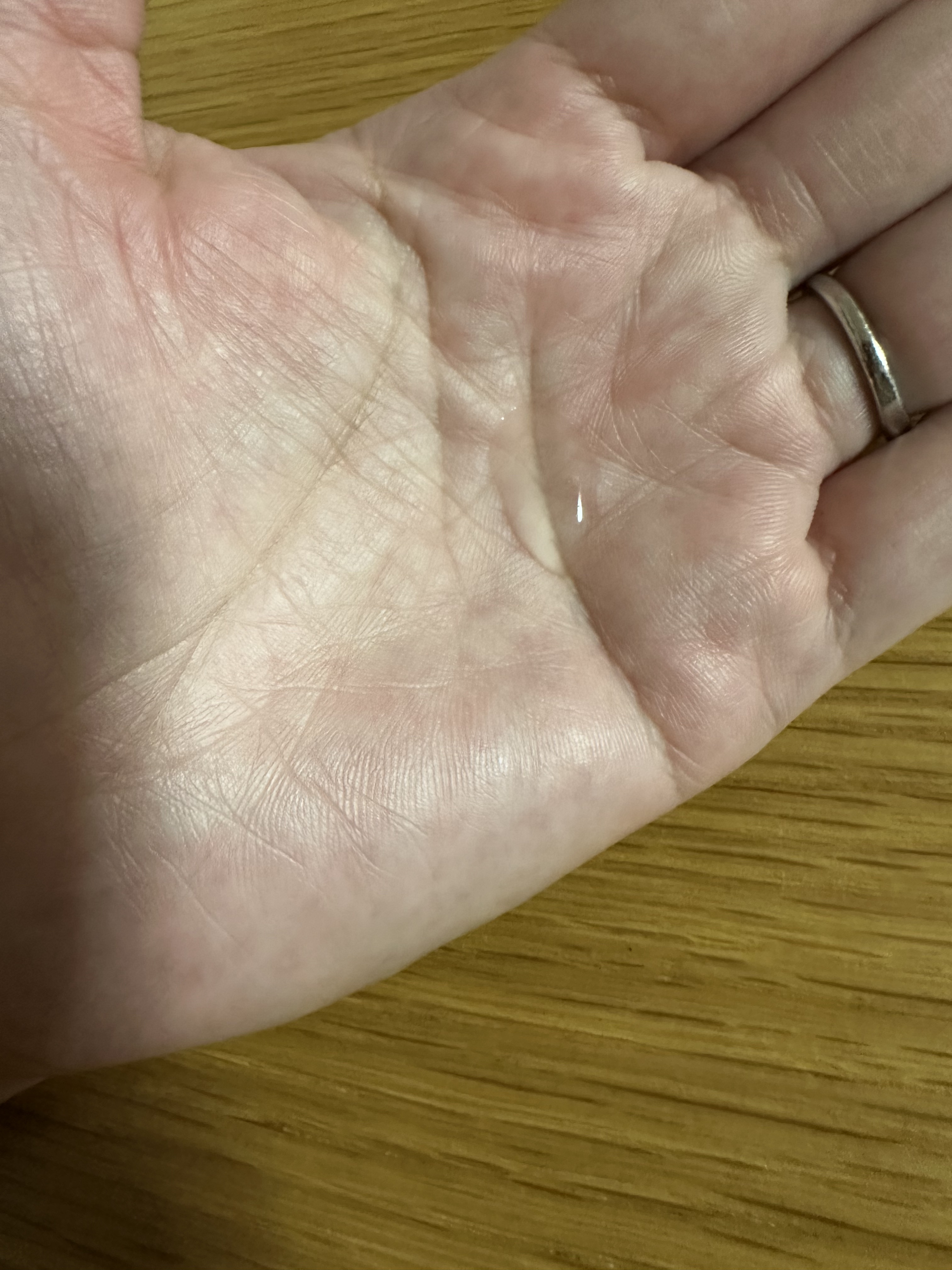 ヒアルロン酸原液/太陽のアロエ社/美容液を使ったクチコミ（3枚目）