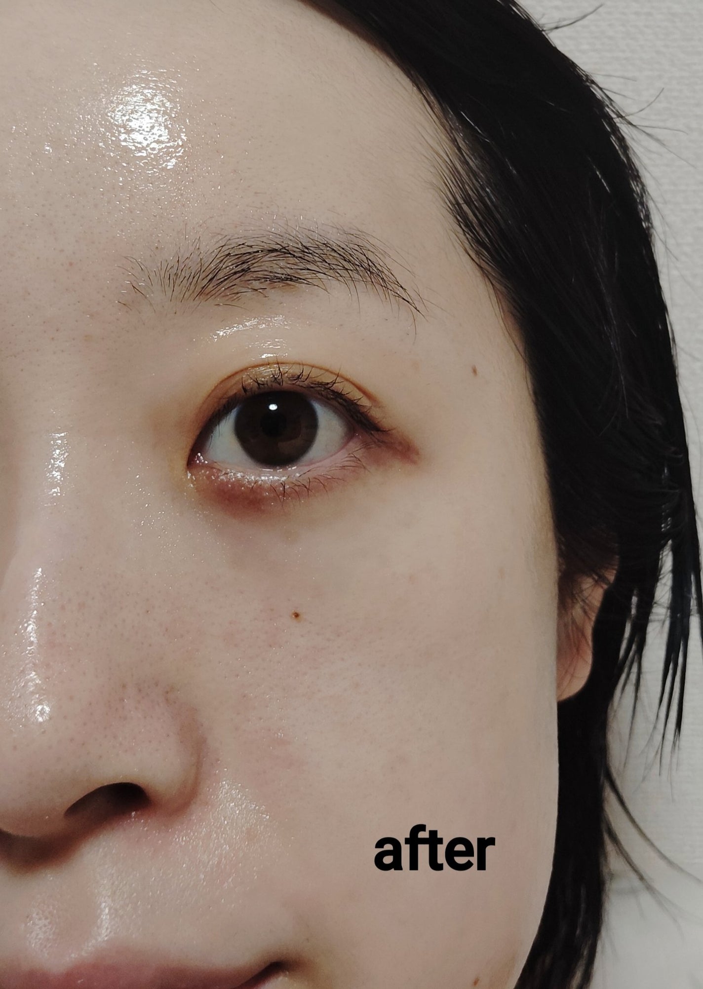 C×AZ ダーマインショット200/ESIENCE/美容液を使ったクチコミ(5枚目)