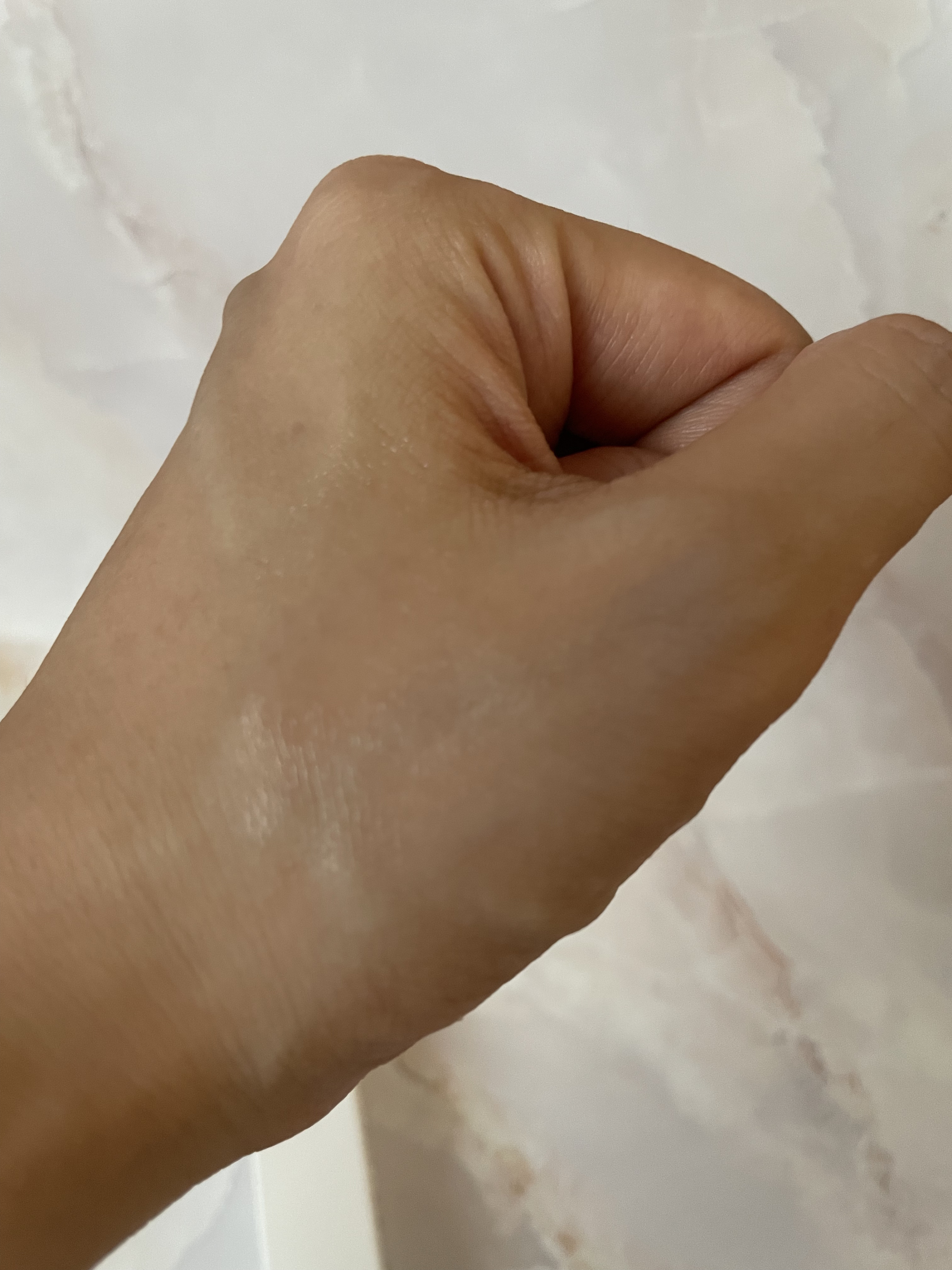 lujo ニードルセラム/lujo/美容液を使ったクチコミ（3枚目）