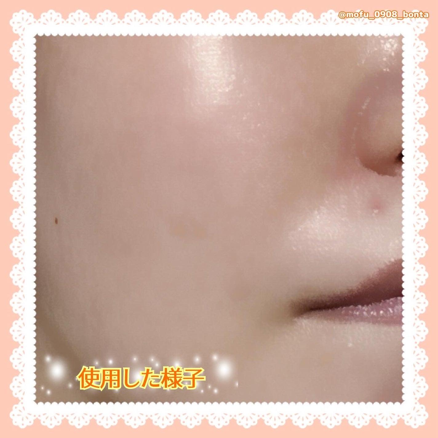 ツボクサ エッセンス/mixsoon/美容液を使ったクチコミ(7枚目)