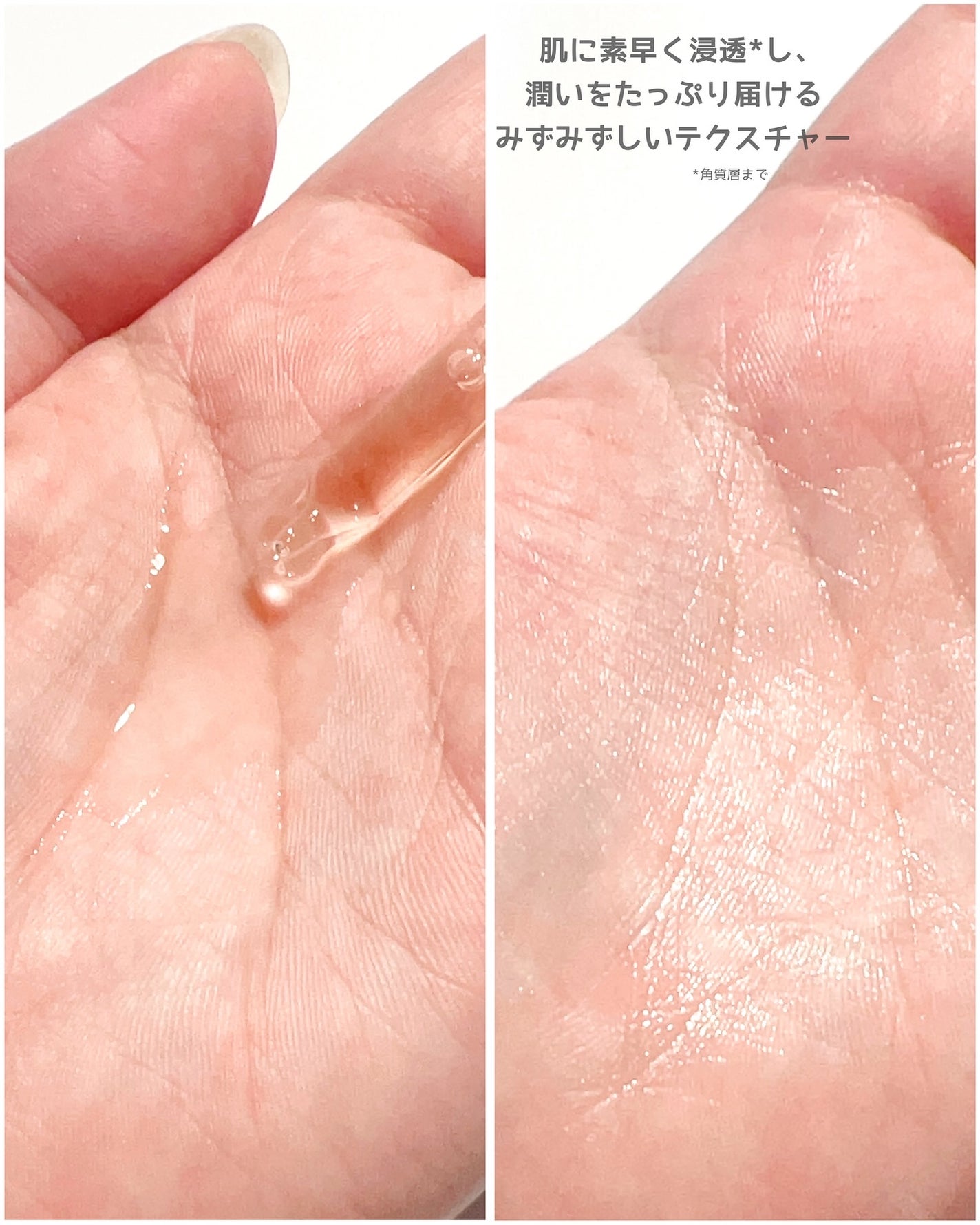 センテラ アンプル/SKIN1004/美容液を使ったクチコミ(4枚目)