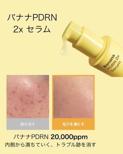 バナナ PDRN 2X セラム/Celladix/美容液を使ったクチコミ(2枚目)