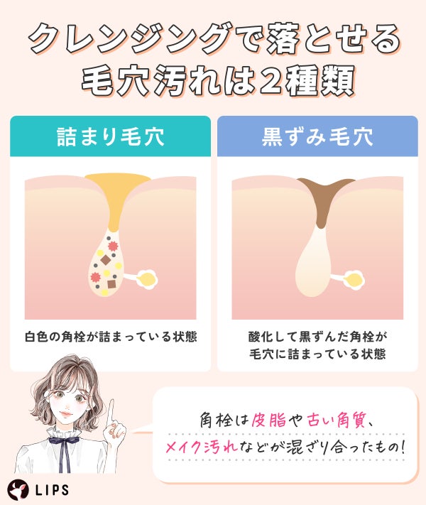 クレンジングで落とせる毛穴汚れは2種類。詰まり毛穴は白色の角栓が詰まっている状態。黒ずみ毛穴は酸化して黒ずんだ角栓が毛穴に詰まっている状態。角栓は皮脂や古い角質、メイク汚れなどが混ざり合ったもの!