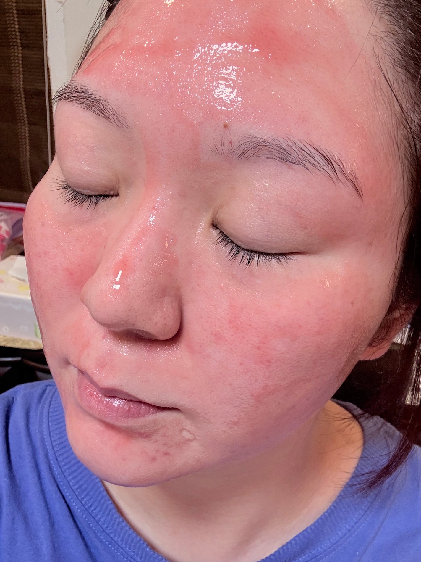 リードルS ピールオフパック/VT/シートマスク・パックを使ったクチコミ(5枚目)