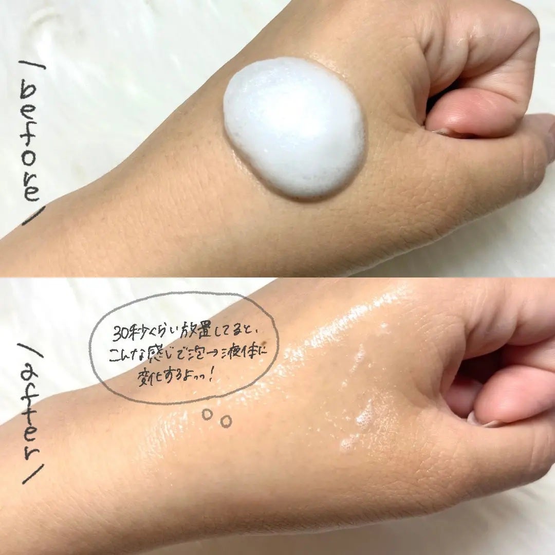 PDRNコラーゲンバブルセラム/CELORABY/美容液を使ったクチコミ(3枚目)