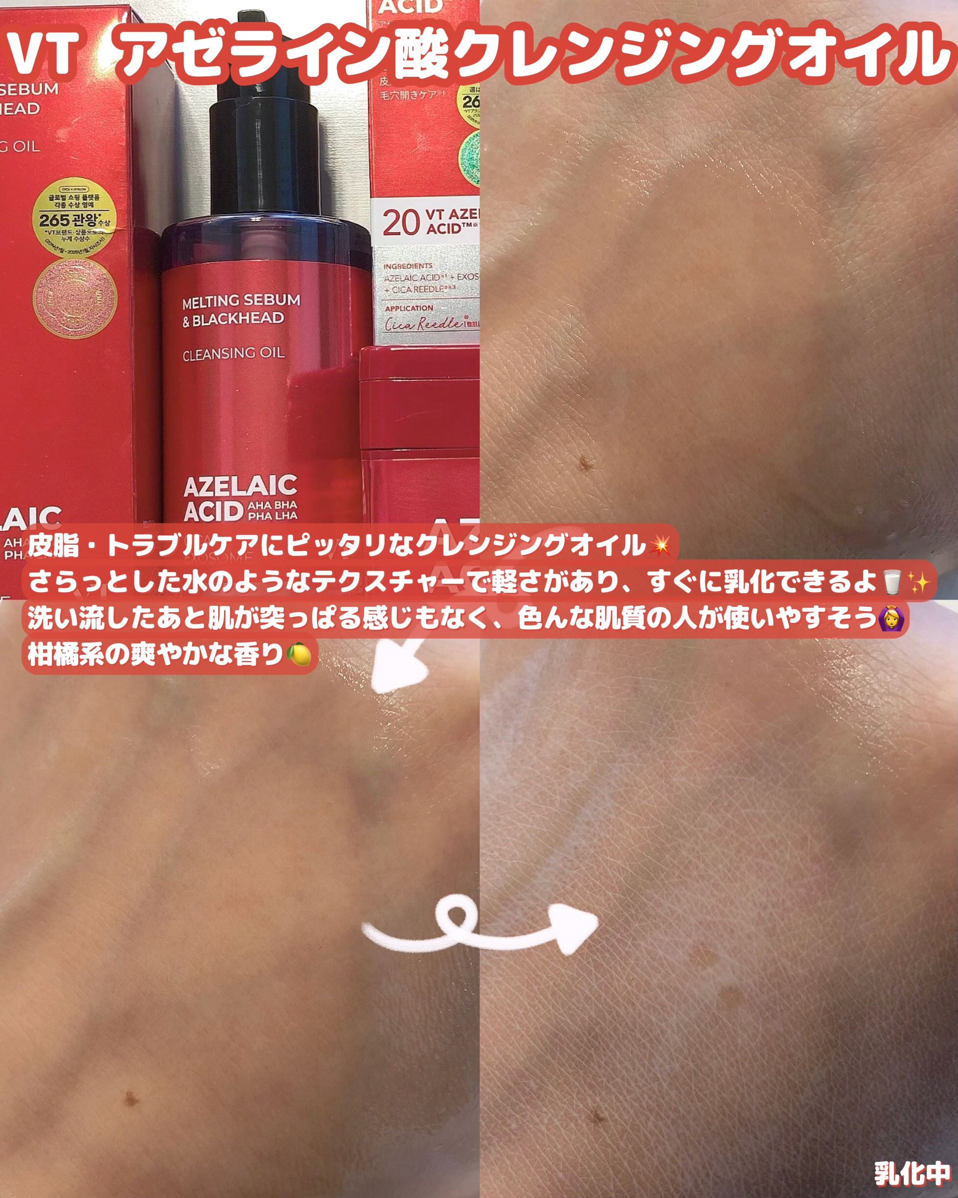 A1カーミング アンプル/VT/美容液を使ったクチコミ（2枚目）