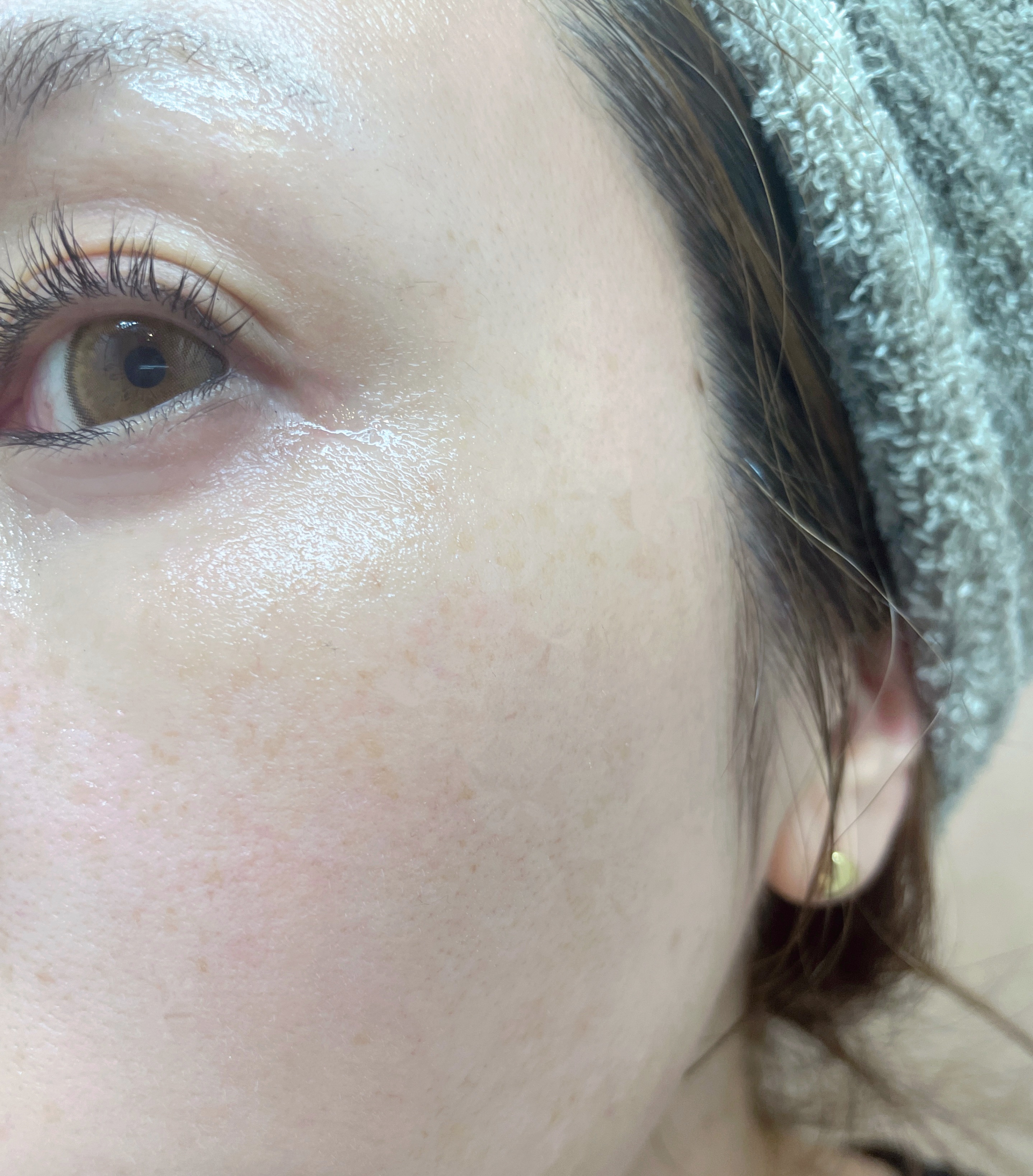 EPL キュアクリームXD/Dr.Oracle/フェイスクリームを使ったクチコミ（3枚目）